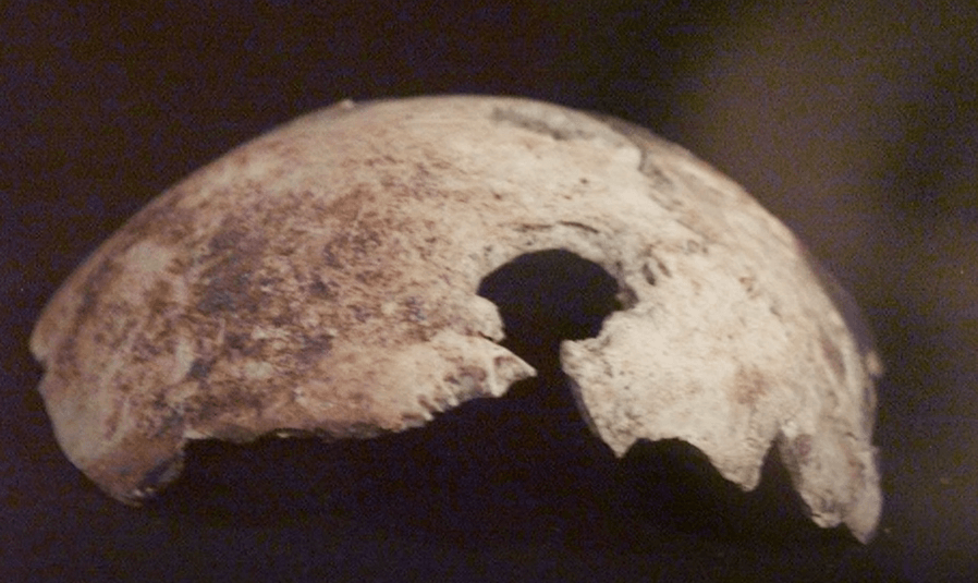 Hitler's Skull!